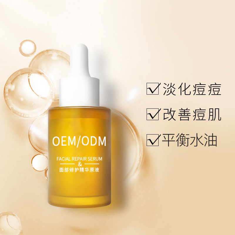 爱碧丽_祛痘精华原液OEM
